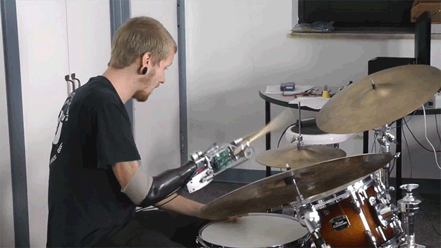 Un baterista perdió un brazo y la ciencia lo convirtió en un súper músico