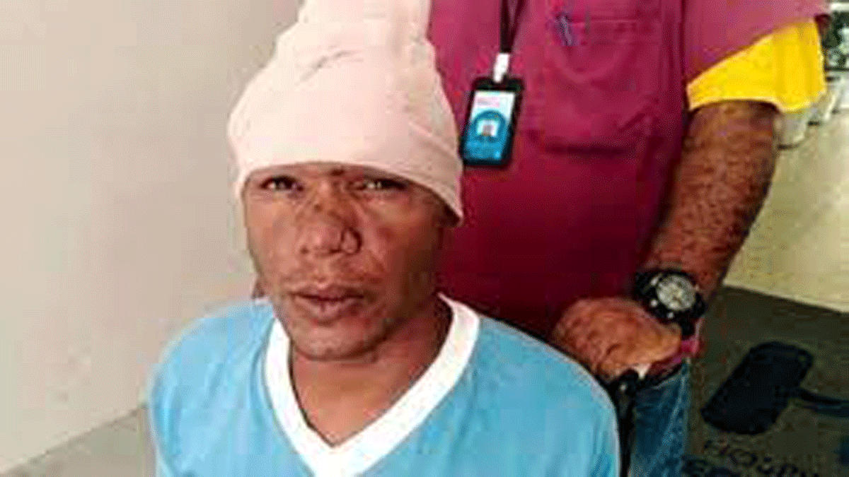 Tremendo. Se metió un clavo en el cráneo porque sentía el cerebro flojo.