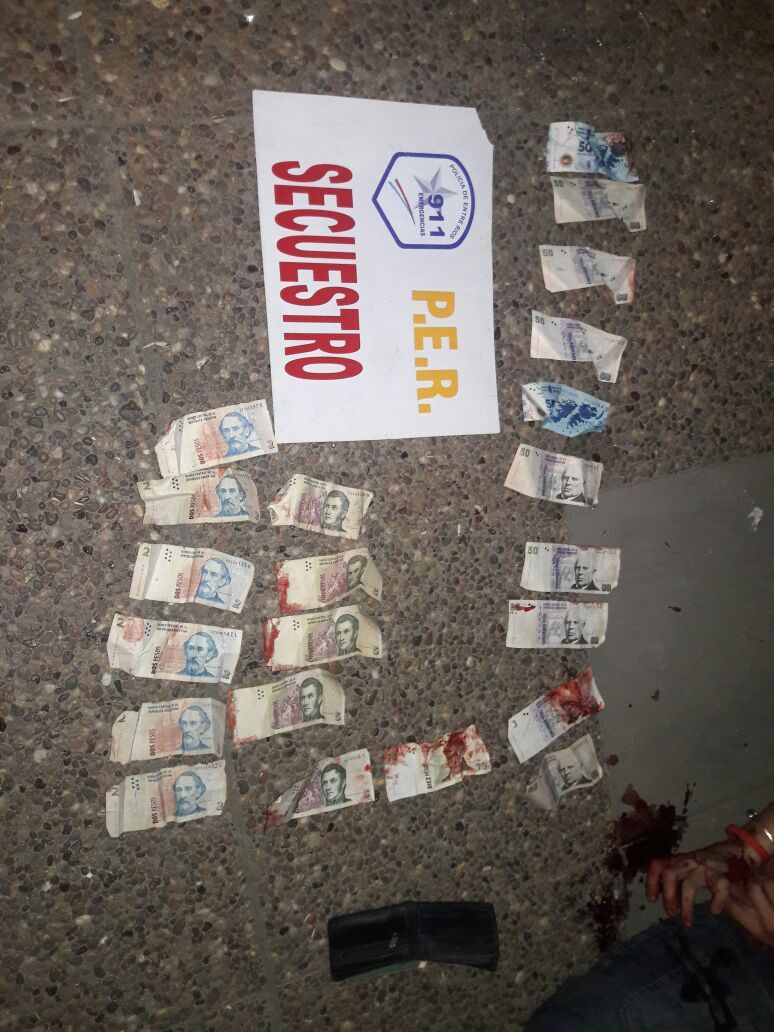 Las manos del joven cortadas y el dinero manchado con sangre.&nbsp;