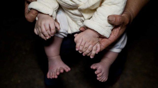 El niño tiene 15 dedos en sus manos y 16 en los pies. Foto: Getty Images.