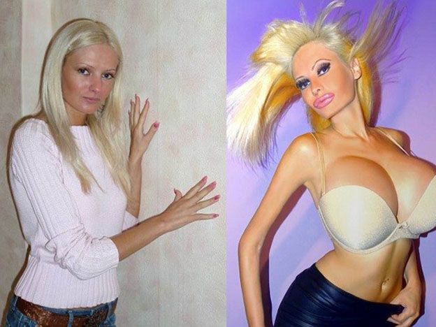 Victoria Wild antes y después.