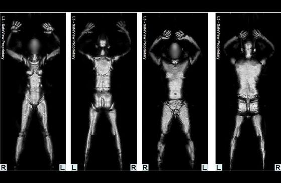 Uno de los formatos de imagen que se puede obtener a través de estos naked scanners.