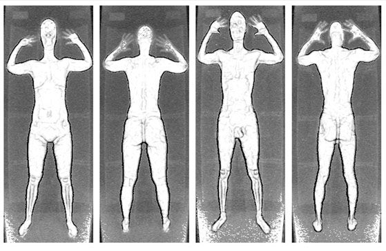 Otro tipo de imagen que se puede obtener a través de estos naked scanners.