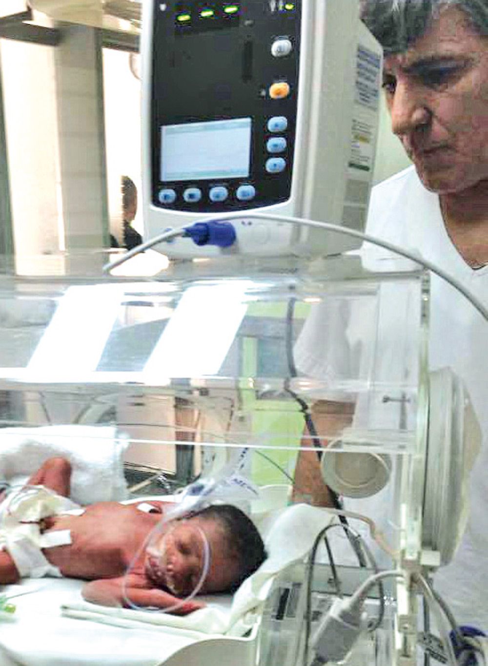 En la incubadora. Una de las tres niñas es controlada todo el tiempo, como sus hermanas. En la incubadora. Una de las tres niñas es controlada todo el tiempo, como sus hermanas.