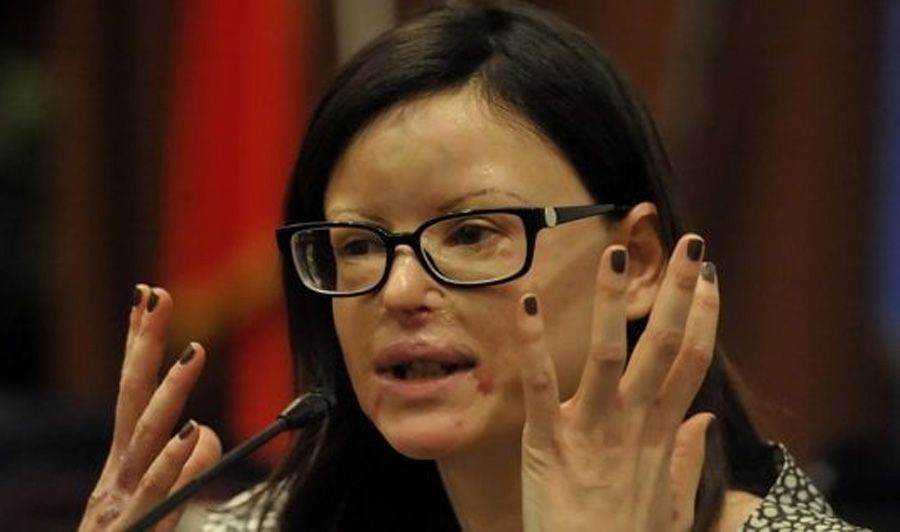Lucia Annibali.