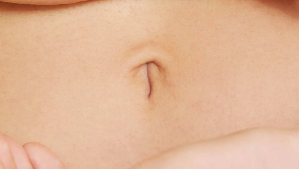 Ombligo en T. Ombligo en T. 