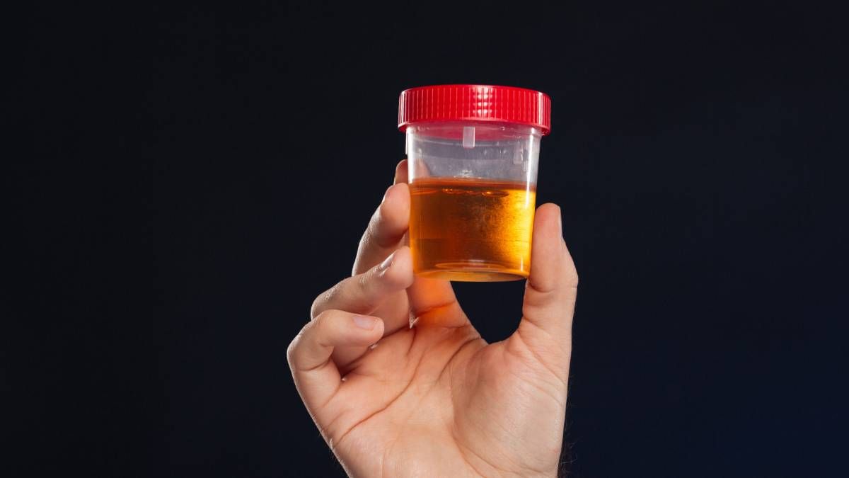 Qué significa beber orina para la salud. Qué significa beber orina para la salud.