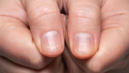 Uñas rayadas: qué significa que una persona las tenga de esa manera