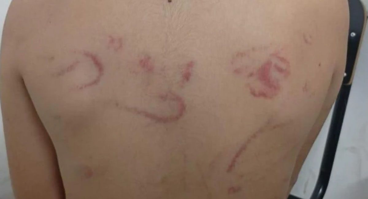 El niño era sometido por su madre, que es catequista, a constantes golpes en el cuerpo, y fue denunciada por su propio hermano El niño era sometido por su madre, que es catequista, a constantes golpes en el cuerpo, y fue denunciada por su propio hermano