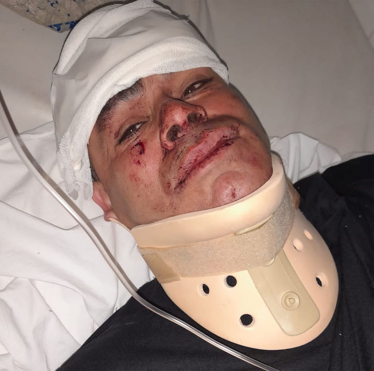 El Auxiliar 1º Diego García, de UMAR del Valle de Uco, fue herido al recibir un piedrazo en su cara en los disturbios e intento de saqueos en Tunuyán. El Auxiliar 1º Diego García, de UMAR del Valle de Uco, fue herido al recibir un piedrazo en su cara en los disturbios e intento de saqueos en Tunuyán.