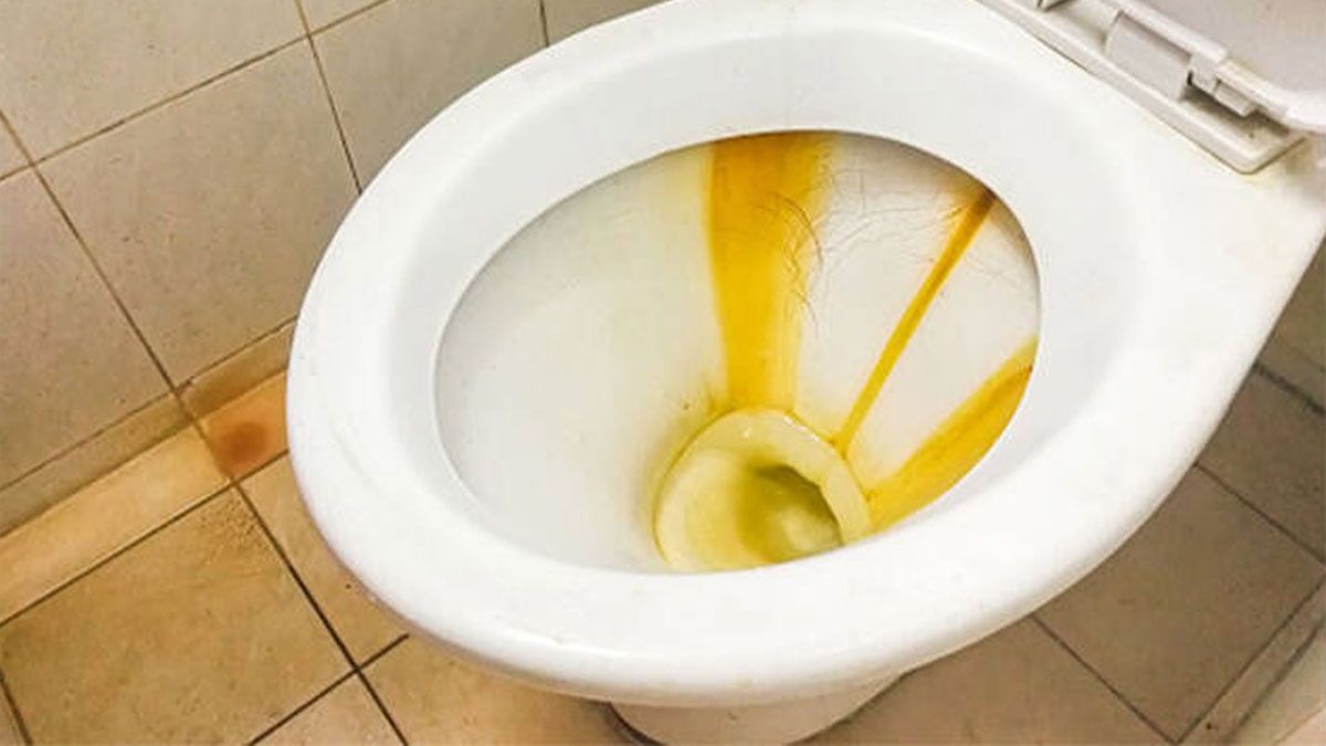 El inodoro y el bidet se tienen que limpiar al menos una vez a la semana, para evitar la acumulación de sedimentos. El inodoro y el bidet se tienen que limpiar al menos una vez a la semana, para evitar la acumulación de sedimentos.