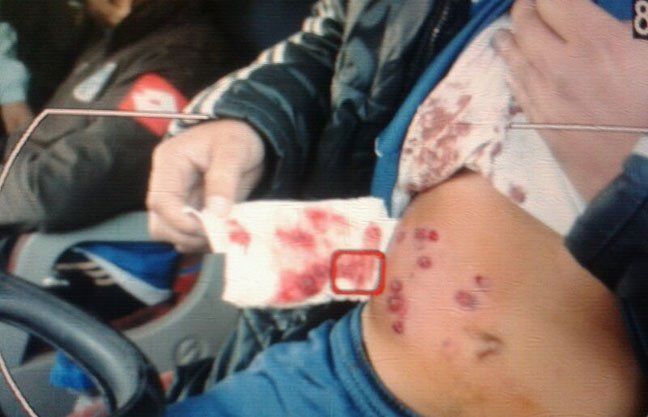 La policía de San Juan reprimió duramente a los tombinos y un hincha perdió un ojo