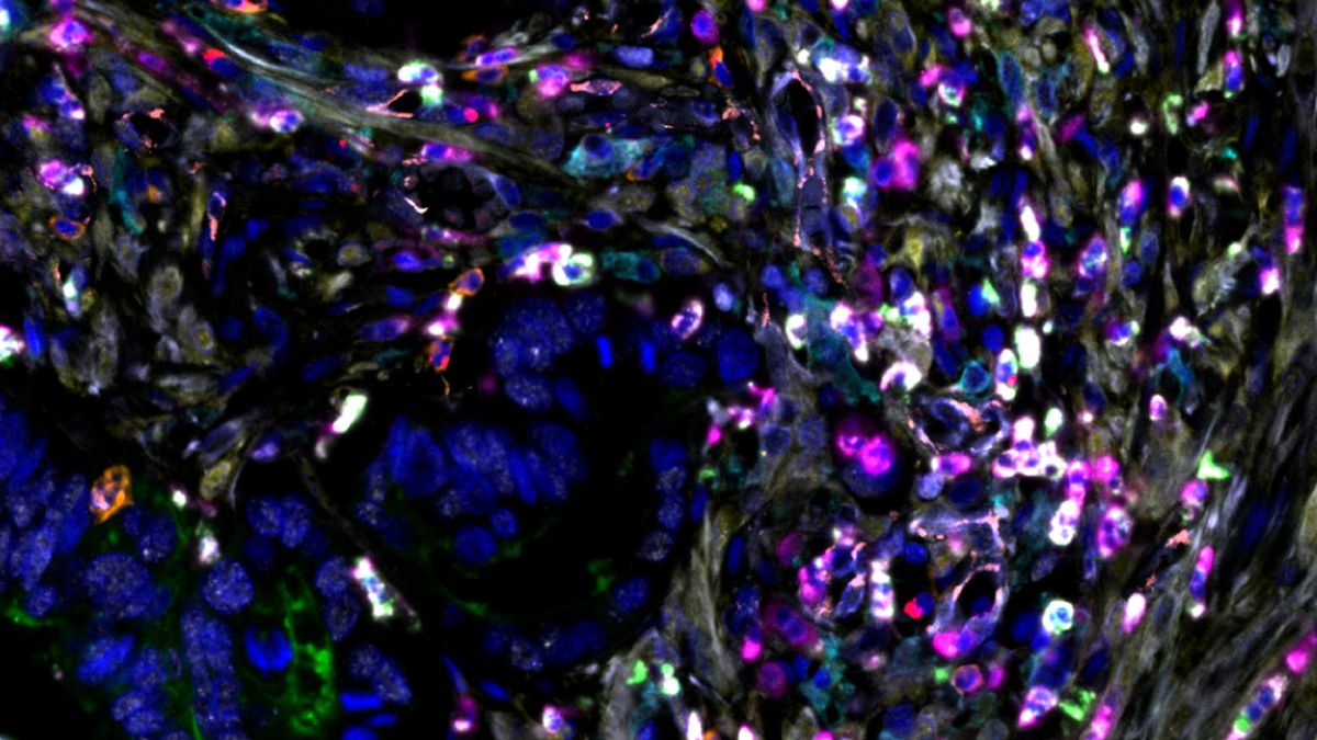 Este descubrimiento podría ayudar a que las células combatan el cáncer antes de ayudarlo. Este descubrimiento podría ayudar a que las células combatan el cáncer antes de ayudarlo.