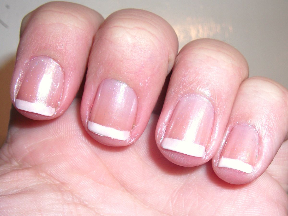 ¿Qué significa que las uñas crezcan demasiado rápido? Nada malo, generalmente. ¿Qué significa que las uñas crezcan demasiado rápido? Nada malo, generalmente.