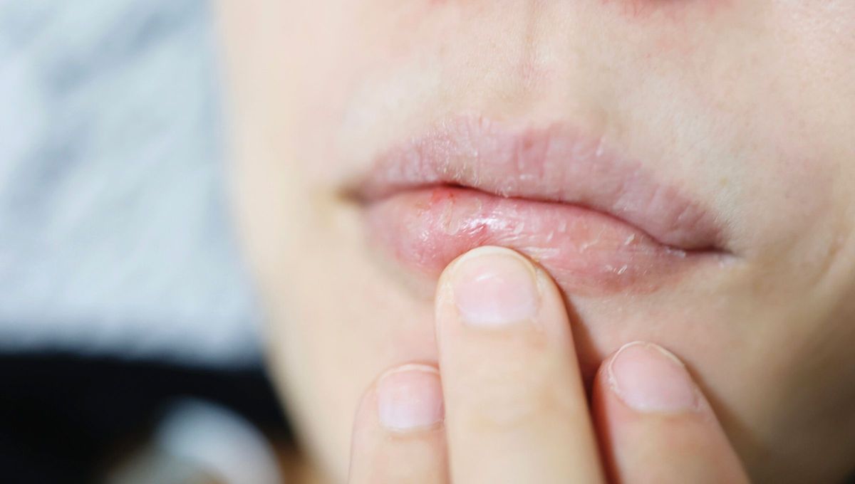 sta acción no solo puede lastimar nuestros labios, sino que además trae consigo una curiosa interpretación del tipo de personalidad. sta acción no solo puede lastimar nuestros labios, sino que además trae consigo una curiosa interpretación del tipo de personalidad.