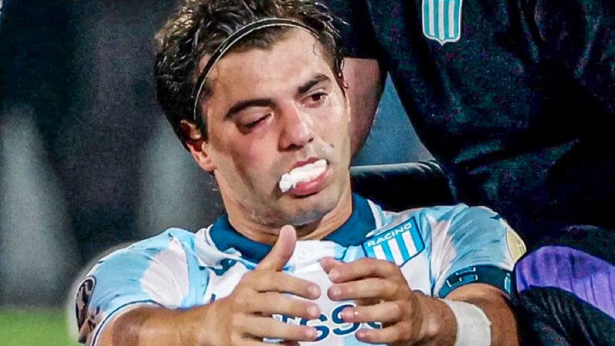 Una buena y una mala para Racing: Santiago Sosa fue operado con éxito, pero no jugará contra Flamengo
