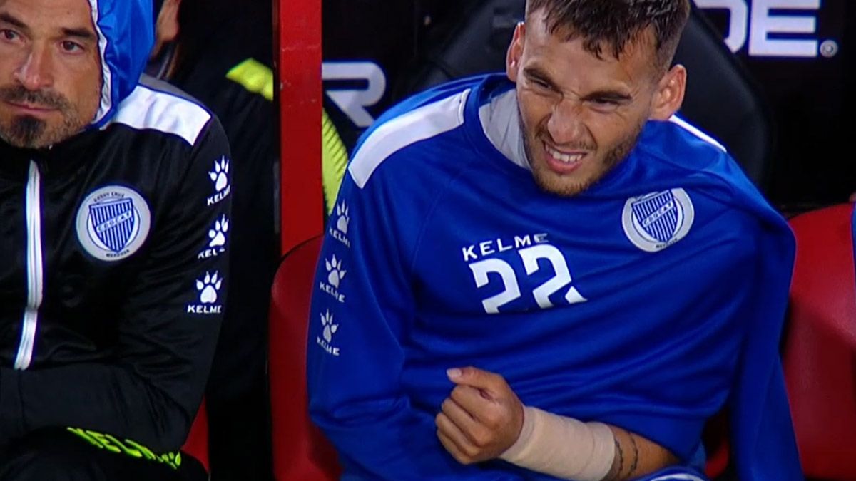 Renzo Tesuri asustó a todos con un corte muy profundo