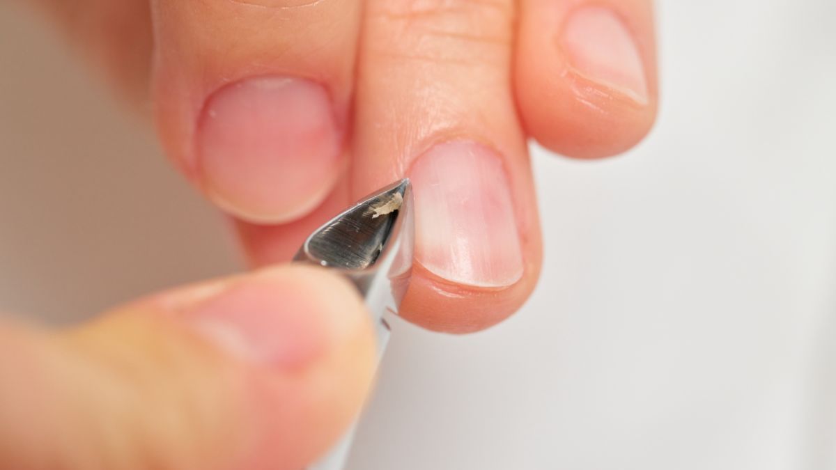 Cutículas inflamadas: cómo surgen y cómo cuidarlas