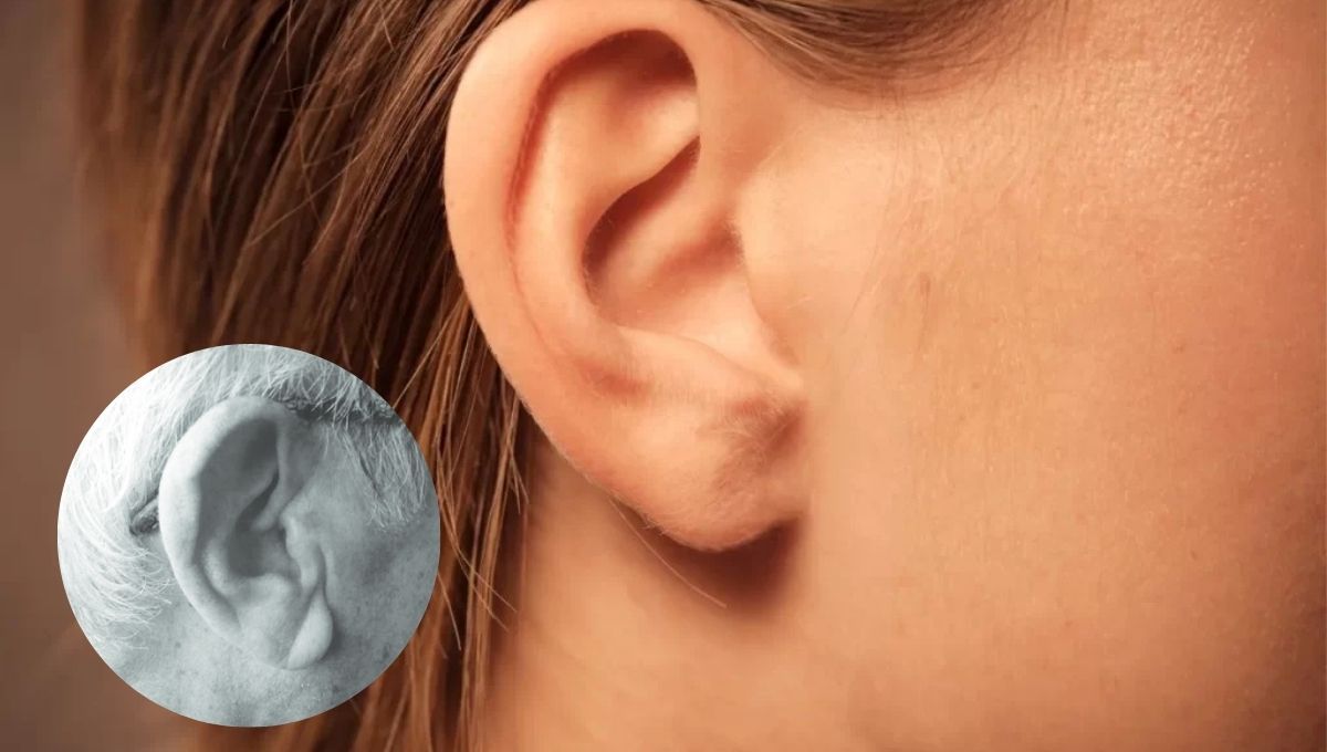 ¿Qué significa tener un pliegue en la oreja?