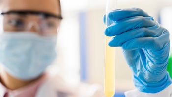 Un concejal peronista propuso narcotests obligatorios cada 6 meses para funcionarios comunales Un concejal peronista propuso narcotests obligatorios cada 6 meses para funcionarios comunales