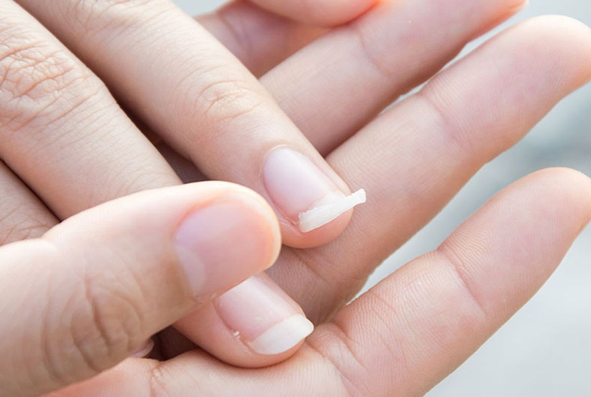 Aprendé a reparar una uña rota gracias a estos 3 trucos. Aprendé a reparar una uña rota gracias a estos 3 trucos. 