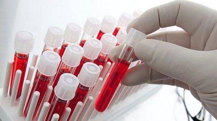 Biopsia líquida, la imagen precisa del paisaje genómico del tumor