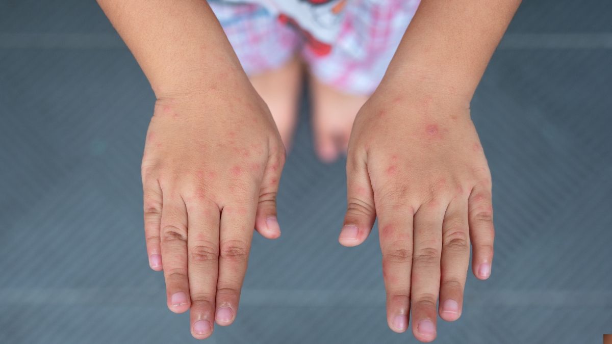 La enfermedad La enfermedad