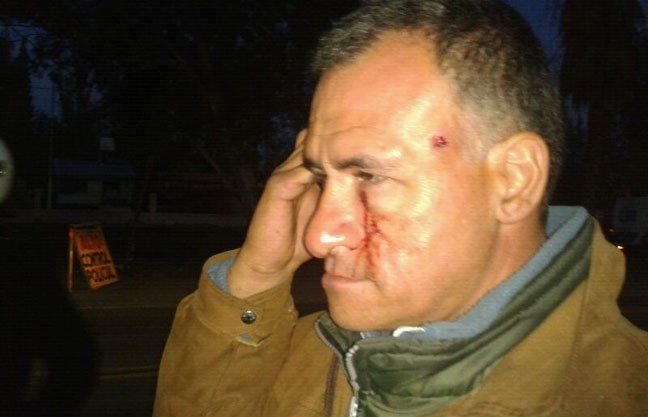 Un hincha del Tomba se descompensó y en el hospital le encontraron un perdigón detrás de un ojo