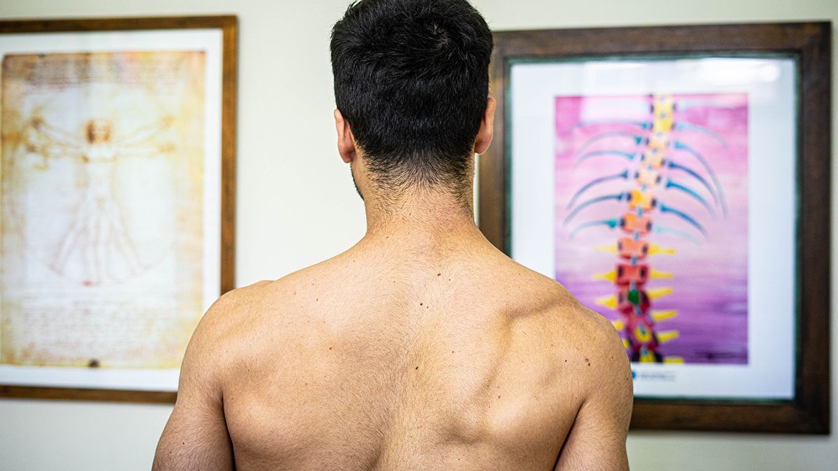 Los hombros en diferentes alturas, uno de los síntomas físicos que evidencian escoliosis. 