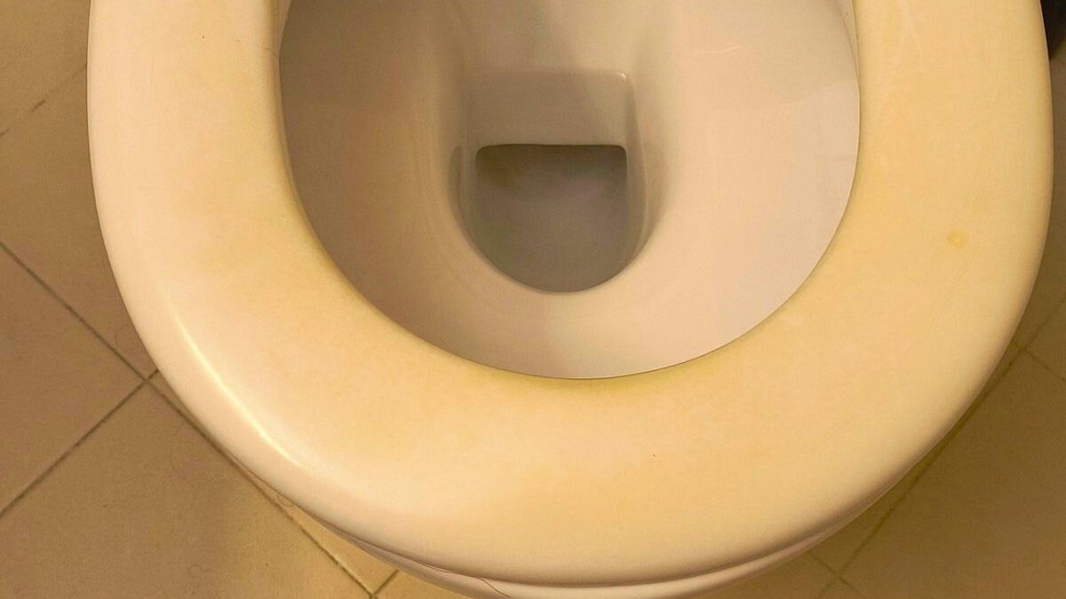 La tapa del inodoro puede recuperar su aspecto original con estos trucos caseros para limpiar.