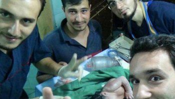 Médicos sirios salvan a una niña que nació con un proyectil en la cara