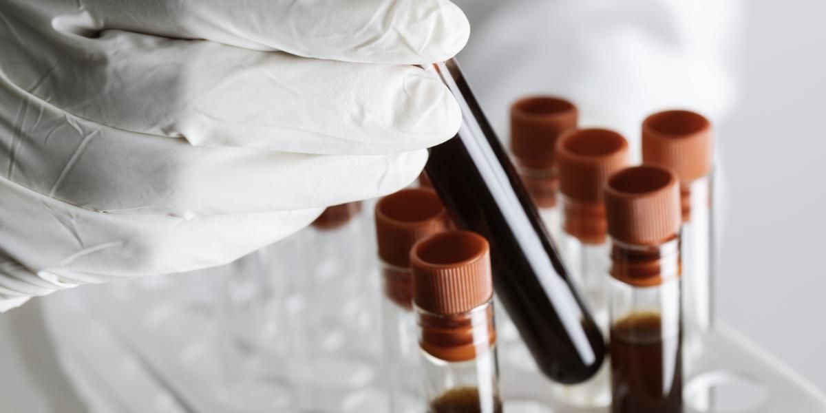 El descubrimiento de un nuevo grupo sanguíneo que se dio después de 50 años El descubrimiento de un nuevo grupo sanguíneo que se dio después de 50 años