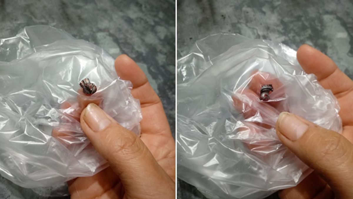 La autopsia del zorro Juancho fue realizada por la veterinaria Jennifer Ibarra, titular de la Fundación Cullunche, quien sacó los proyectiles del animal. La autopsia del zorro Juancho fue realizada por la veterinaria Jennifer Ibarra, titular de la Fundación Cullunche, quien sacó los proyectiles del animal.