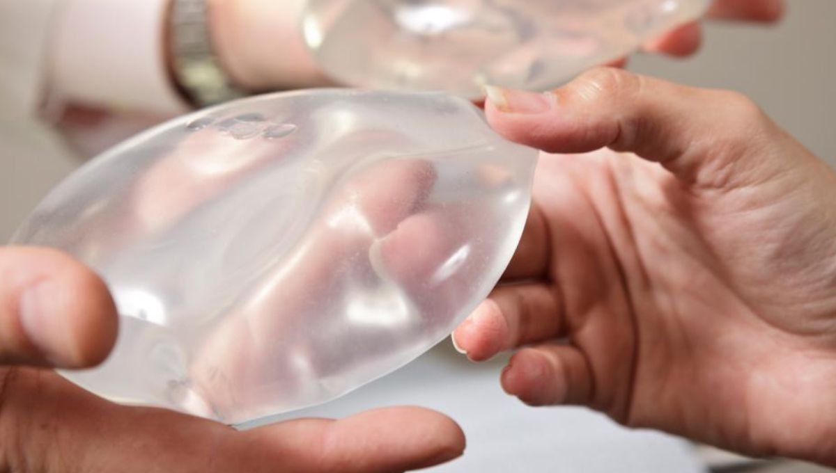 La Administración de Alimentos y Medicamentos de EEUU asoció los implantes de seno con un nuevo tipo de cáncer.