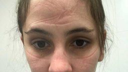 el testimonio de una profesional del hospital central marca como se convive con el virus