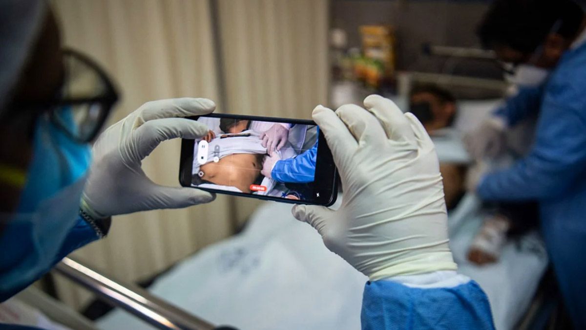 Primera coinfección. Un hombre dio positivo de Covid-19 VIH, viruela del mono y VIH tras un viaje a España