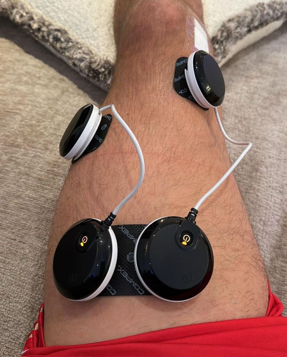 Alexis sufrió un golpe y un corte en la rodilla Alexis sufrió un golpe y un corte en la rodilla