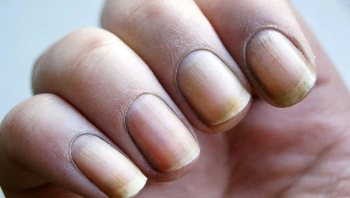 Elimina las manchas amarillas de tus uñas con este ingrediente de cocina