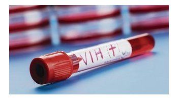 Los contagios por VIH se duplicaron en Chile