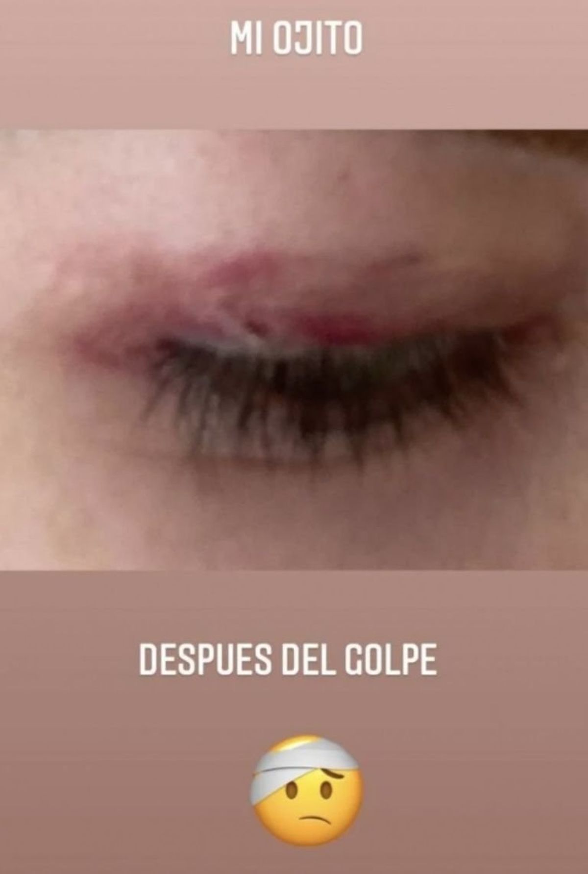 ¡Impactante! Luciana Salazar mostró cómo quedó su cara tras su terrible caída