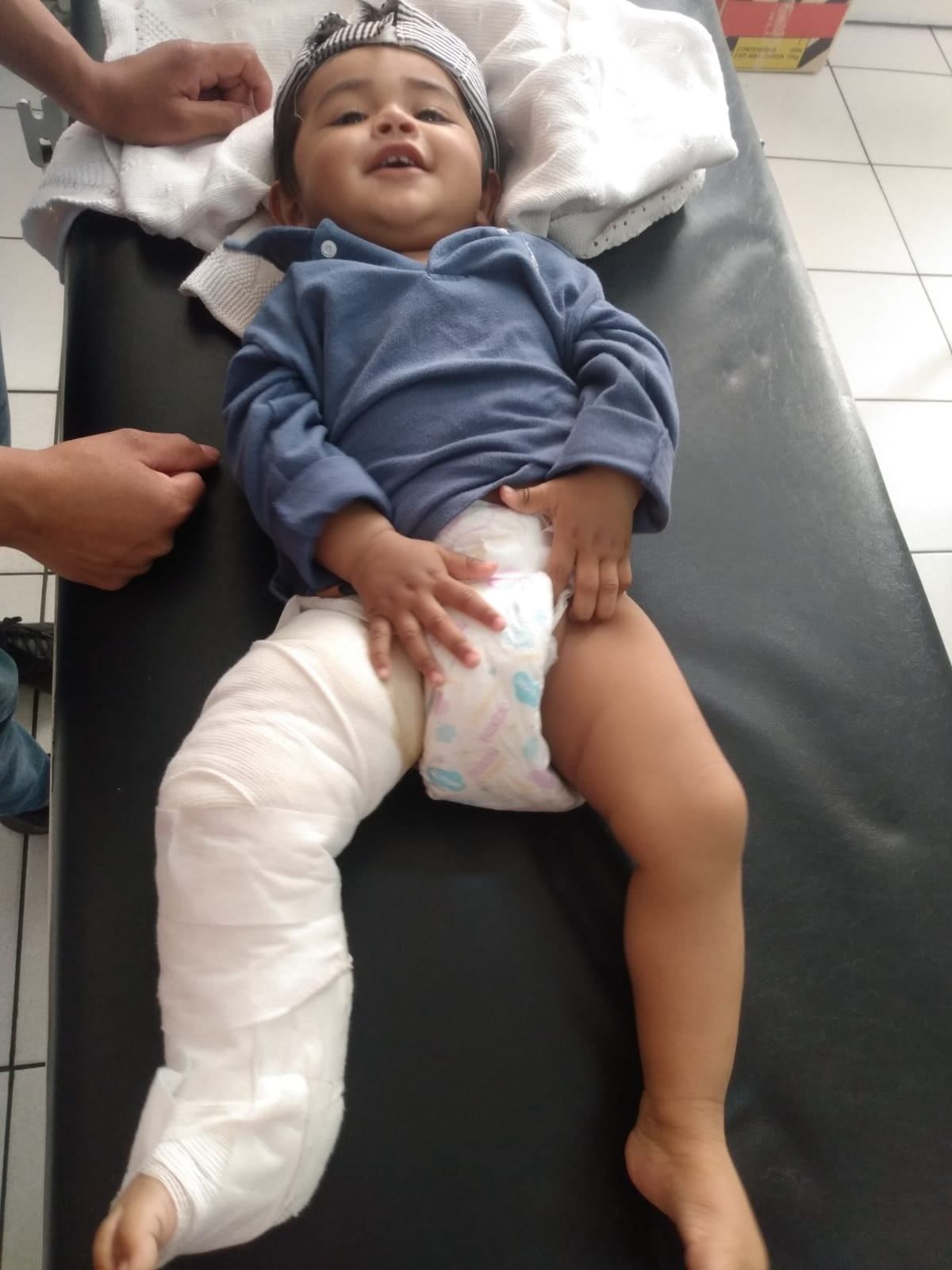 Una de sus curaciones, el mes pasado. Pese a todo, la sonrisa. Una de sus curaciones, el mes pasado. Pese a todo, la sonrisa.