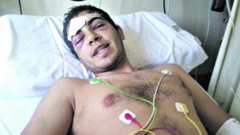 Un joven fue brutalmente atacado por un grupo de seis personas y terminó con fractura de cráneo