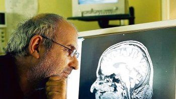 Murió Oliver Sacks, el gran neurólogo autor de 