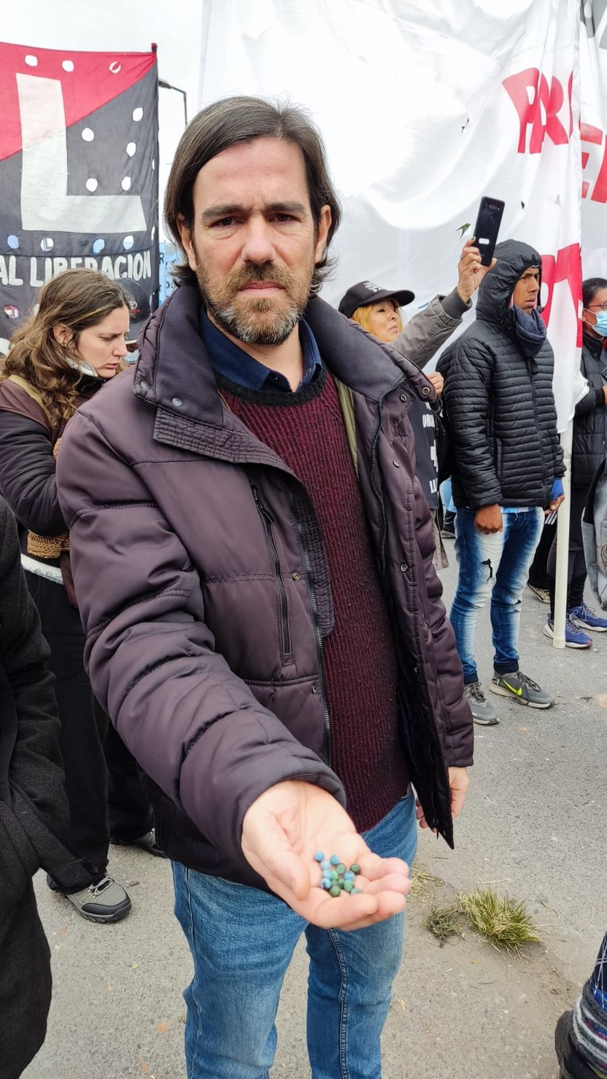 Nicolás del Caño mostró los perdigones que lanzó la Policía contra los jujeños.