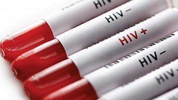Cómo eliminaron los científicos el VIH en 5 pacientes y qué harán ahora
