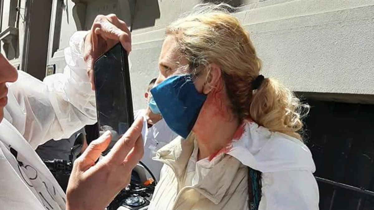 Enfermeros fueron golpeados durante una protesta en la Legislatura porteña