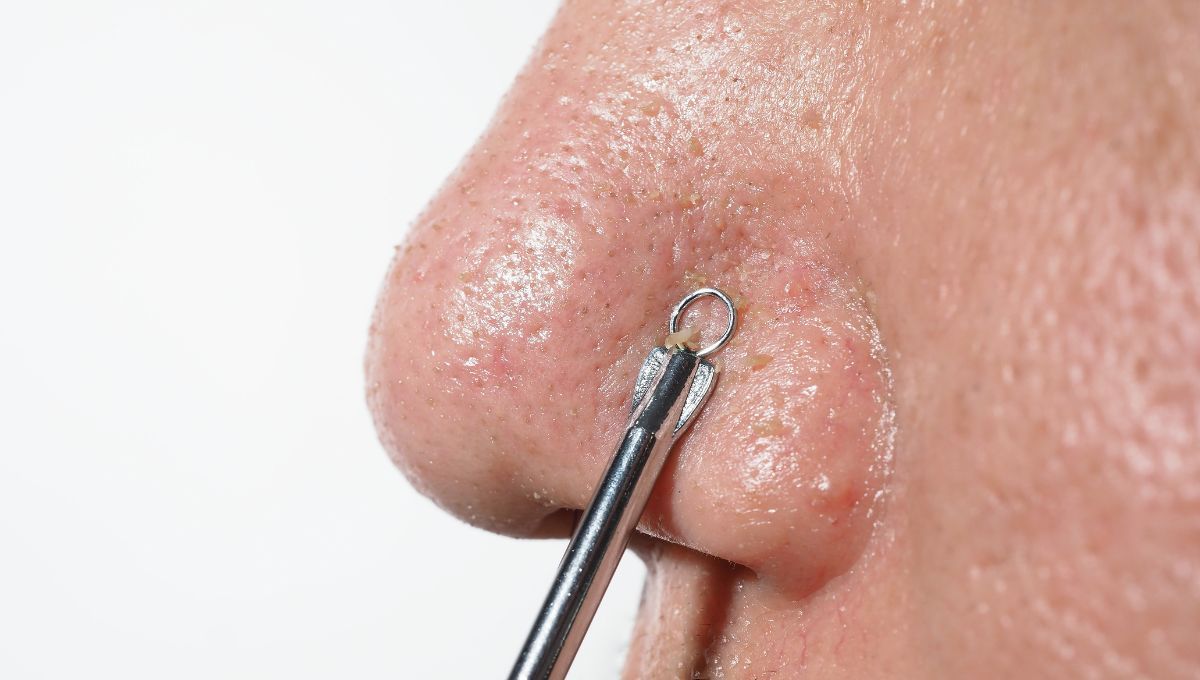 Puntos negros. Puntos negros. 