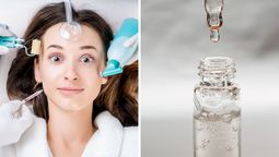 ¿Por qué el ácido salicílico revoluciona el cuidado facial?