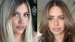 Explosión por los nuevos labios de Wanda Nara: Te queres parecer a la China Suárez