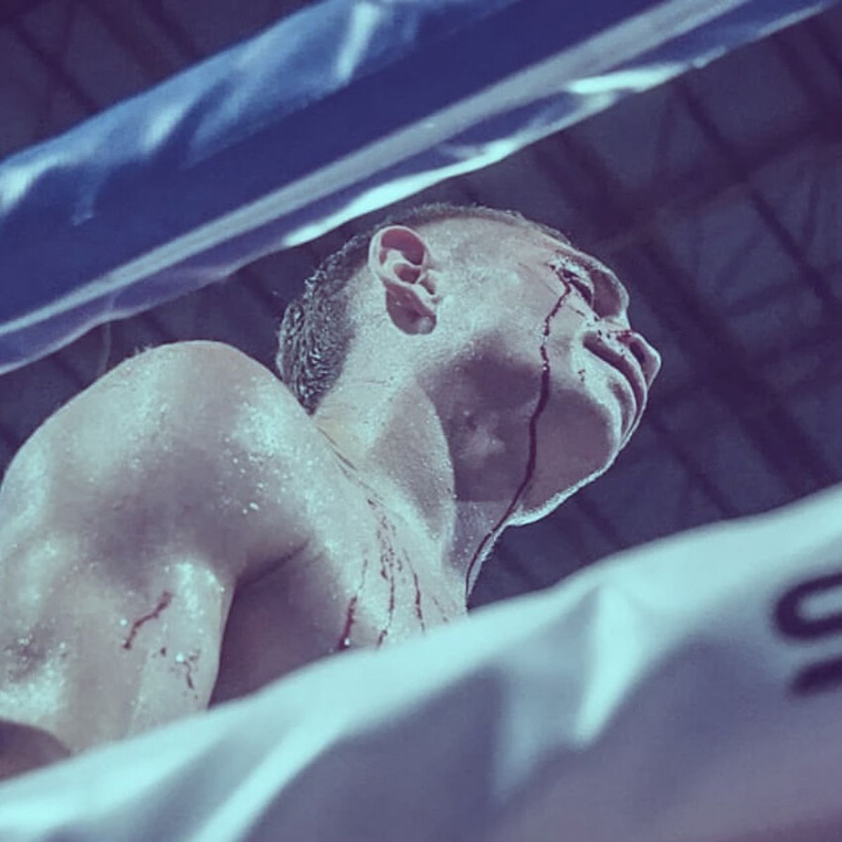 Así fue el corte que sufrió Coki Soto en el primer pleito contra Pereyra, en Catamarca. Así fue el corte que sufrió Coki Soto en el primer pleito contra Pereyra, en Catamarca.